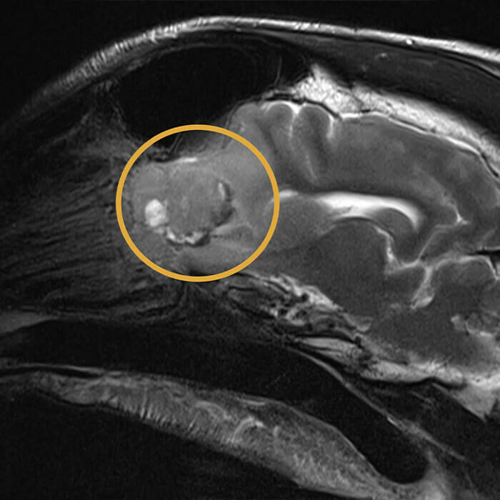 12-year-old, female-spayed Golden Retriever presented for multiple seizure episodes.