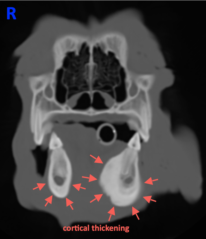 Case Report craniomandibular osteopathy – “Cheeky cheek”