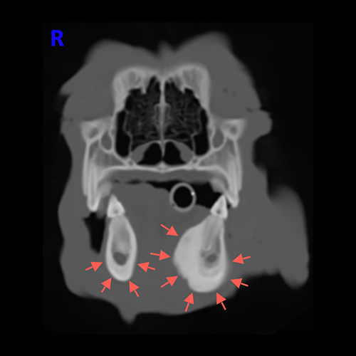 Case Report craniomandibular osteopathy – “Cheeky cheek”